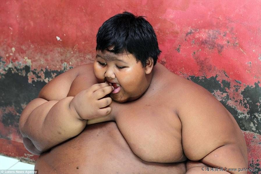 世界最胖的男孩